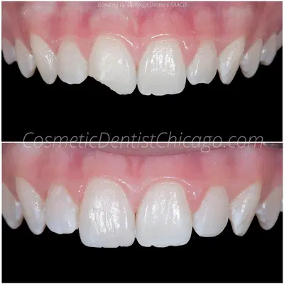Advanced Cosmetic & Implant Dentistry | Kevin Landers DDS FAACD