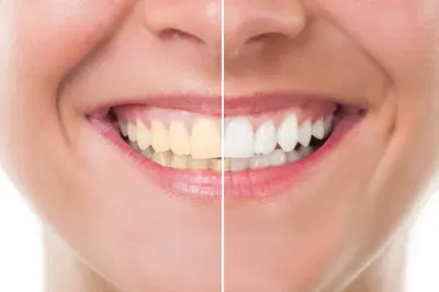 All Family Dental and Braces