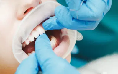 East Erie Dental
