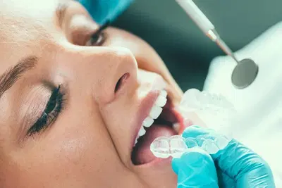 Brad Sammons, DDS - Center for Advanced Dentistry in Indianapolis