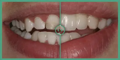 NKC Dental West Plaza