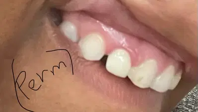 Healthy Smiles - Baton Rouge