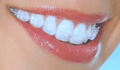 New Orleans Smiles