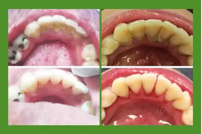 Shrewsbury Dentist - Union Dental - MA