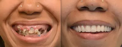 Be More Dental