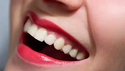SmileHere Family Dental
