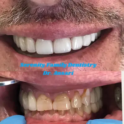 Serenity Family Dentistry, PLLC