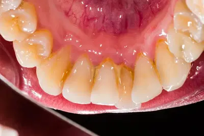 Kingston Dental Care in St. Louis, MO