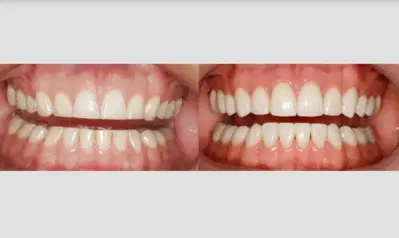 Charlotte Center for Cosmetic Dentistry