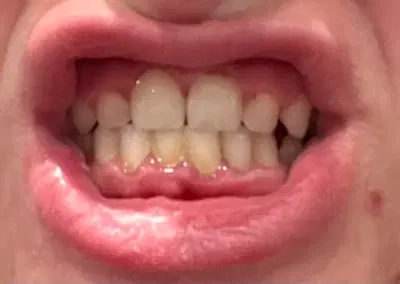 Millard Hills Dental Health Center