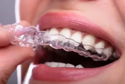 Success Smiles Orthodontics