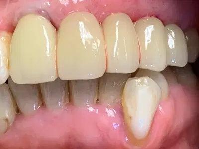 Apex Dental