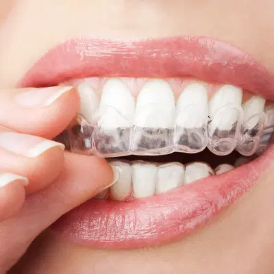 Nevada Dentistry & Braces