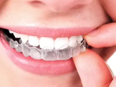 Smile Squad Kids Dentistry & Braces
