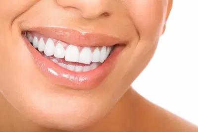 Smiles 4U Dental