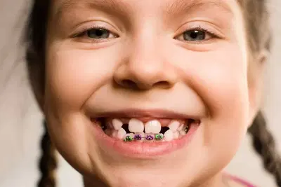 Las Vegas Braces- Dr. Griffiths, Dr. Simister & Dr. Whiting Orthodontics