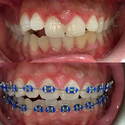 Embrace Dental