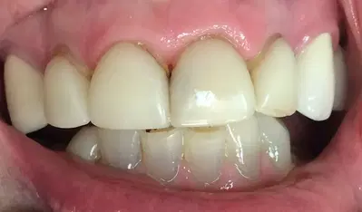 Double Diamond Dental: Michael A Morgan DDS