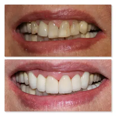 CrossKeys Dental