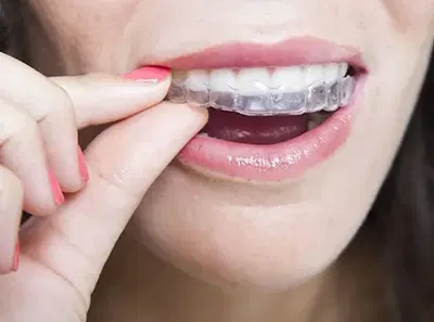 Adirondack Orthodontics