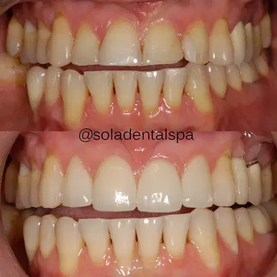 Sola Dental Spa