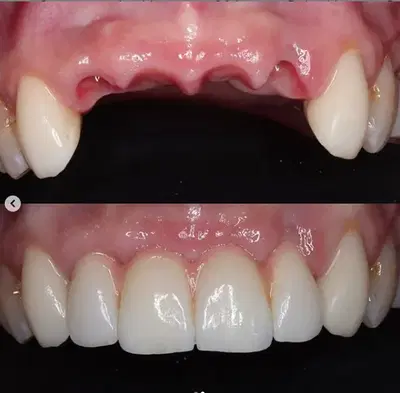NYC Smile Design