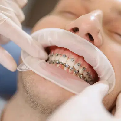 West Side Orthodontics