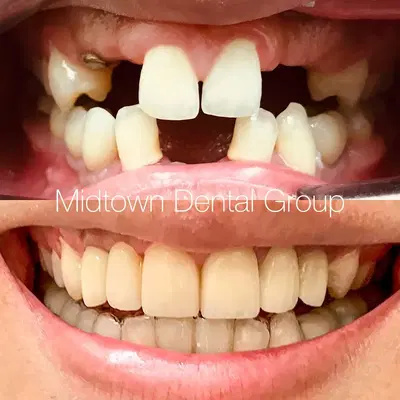 Midtown Dental Group Upper East Side