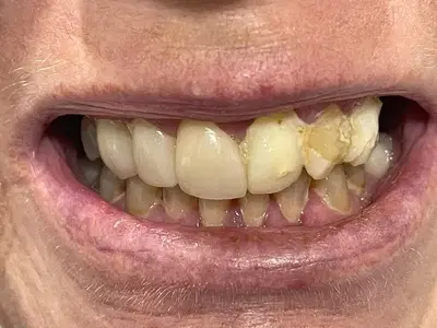 ACE dental