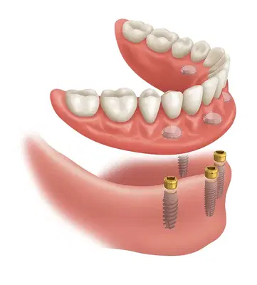 Zealous Dental Dayton