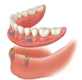 Pleasant Run Dental