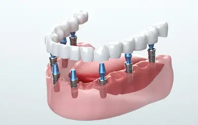 Zealous Dental Springdale