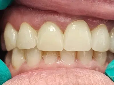 Summit Dentistry