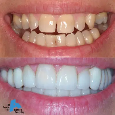 The Center for Advanced Dentistry