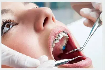 Precision Orthodontics