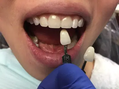 Progressive Dental-Matthew McReynolds