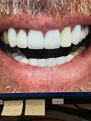 Joe Isaacson Dental
