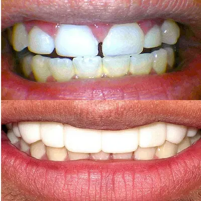 Perfect Smile - Dentist in Tulsa, OK