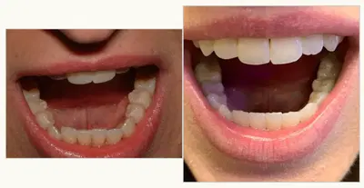 Silvers Family Dental Care