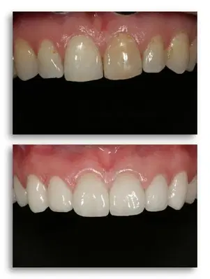 Opus Dental Esthetics: Dr. Doray & Dr. Conover