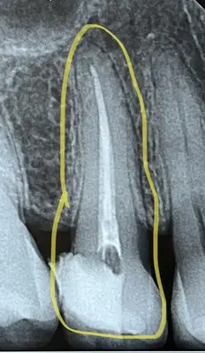 Fountain City Endodontics