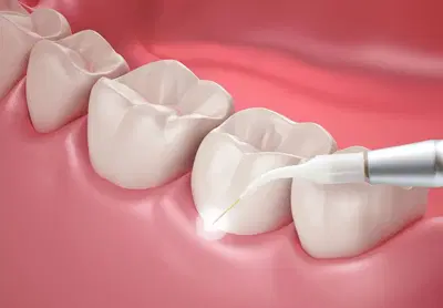 Implant and Family Dentistry: Timothy J. Hacker, DDS