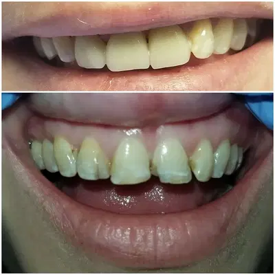 Arlington Dental - Cordova