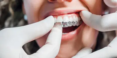 Southwind Dental Care