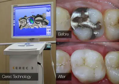 Dean Cosmetic Dentistry Center