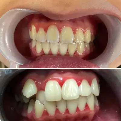 Hermosa Dental of Little York