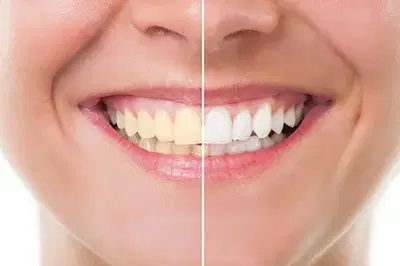 BLVD Dentistry & Orthodontics of 5th Street
