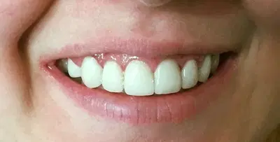 BLVD Dentistry & Orthodontics- Riverside