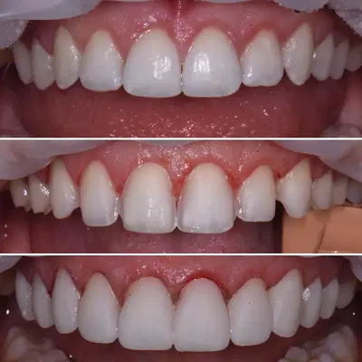 Austin Cosmetic Dentistry by Tejas Patel, DDS