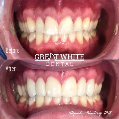 Great White Dental